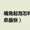 嘴角起泡怎样痊愈最快方法（嘴角起泡怎样痊愈最快）