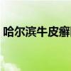 哈尔滨牛皮癣医院排名（哈尔滨牛皮癣医院）
