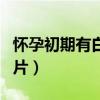 怀孕初期有白带正常吗（怀孕初期白带症状图片）
