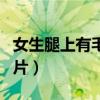 女生腿上有毛孔怎么办（女生腿上毛囊堵塞图片）