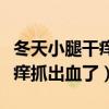 冬天小腿干痒抓出血了用什么药（冬天小腿干痒抓出血了）