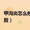 甲沟炎怎么修剪指甲视频（甲沟炎自己怎么修剪）