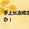 手上长冻疮怎么办才能不痒（手上长冻疮怎么办）