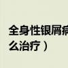 全身性银屑病是不是治不好（全身性牛皮癣怎么治疗）
