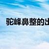 驼峰鼻整的出来吗（驼峰鼻整形要多少钱）