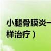 小腿骨膜炎一般在哪些部位（小腿骨膜炎怎么样治疗）