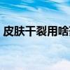 皮肤干裂用啥药膏（皮肤干裂用什么药膏好）