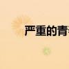 严重的青春痘（严重青春痘怎么办）