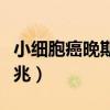 小细胞癌晚期死前兆脚肿（小细胞癌晚期死前兆）