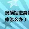 蚂蟥钻进身体里面会怎么样?（蚂蟥钻进了身体怎么办）