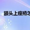 额头上痤疮怎么治（额头上有痤疮怎么办）