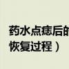 药水点痣后的恢复过程怎么样（药水点痣后的恢复过程）