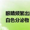 眼睛频繁出白色分泌物 红血丝（眼睛频繁出白色分泌物）