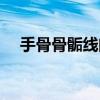 手骨骨骺线闭合图片（骨骺线闭合图片）