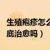 生殖疱疹怎么治疗彻底治愈（生殖器疱疹能彻底治愈吗）