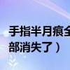 手指半月痕全部消失了怎么办（手指半月痕全部消失了）