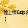 脸上痘印怎么办才能彻底去除（脸上痘印怎么）