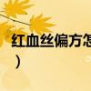 红血丝偏方怎么根治(红血丝根治的偏方大全) 红血丝偏方怎么根治(红血丝根治的偏方大全)