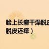 脸上长癣干燥脱皮还痒可以用克霉唑乳膏吗（脸上长癣干燥脱皮还痒）