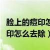 脸上的痘印怎么去除最有效的方法（脸上的痘印怎么去除）