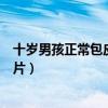 十岁男孩正常包皮是什么样子的图片（包皮是什么样子的图片）