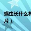 螨虫长什么样子图片大全（螨虫长什么样子图片）
