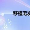 移植毛发价钱（移植毛发效果图）