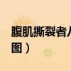 腹肌撕裂者八个动作（腹肌撕裂者3个月效果图）