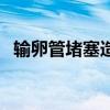 输卵管堵塞造影片(造影输卵管堵塞报告) 输卵管堵塞造影片(造影输卵管堵塞报告)