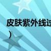 皮肤紫外线过敏涂什么药膏（皮肤紫外线过敏）