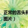 正常的舌头和不正常的舌头图片（正常的舌头图片）