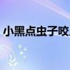 小黑点虫子咬人剧痒（黑点小虫子咬人很痒）