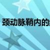 颈动脉鞘内的结构排列（颈动脉鞘内的结构）