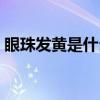 眼珠发黄是什么毛病（眼珠发黄是怎么调理）