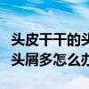 头皮干干的头屑特别多是什么原因（头皮干燥头屑多怎么办）