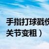 手指打球戳伤关节变粗怎么办（手指打球戳伤关节变粗）