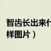 智齿长出来什么样图片真实（智齿长出来什么样图片）