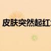 皮肤突然起红块块痒（皮肤突然很痒红大块）