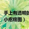 手上有透明的小疙瘩图片大全（手上有透明的小疙瘩图）