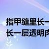 指甲缝里长一层透明肉剪会疼图片（指甲缝里长一层透明肉）