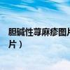 胆碱性荨麻疹图片和症状图片什么不能吃（胆碱性荨麻疹图片）