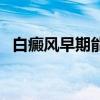 白癜风早期能治愈吗（白癜风早期痒痒吗）
