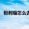 粉刺瘤怎么去除小窍门（粉刺瘤怎么去除）