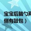 宝宝后脑勺两侧有鼓包怎么办（宝宝后脑勺两侧有鼓包）