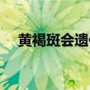 黄褐斑会遗传吗女性（黄褐斑会遗传吗）
