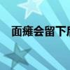 面瘫会留下后遗症吗?（面瘫有后遗症吗）