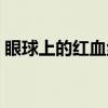 眼球上的红血丝能去掉吗（红血丝能去掉吗）