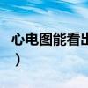 心电图能看出来什么（心电图能查出心脏病吗）