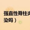 强直性脊柱炎传染吗遗传吗（强直性脊柱炎传染吗）
