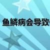 鱼鳞病会导致什么（鱼鳞病会越来越严重吗）